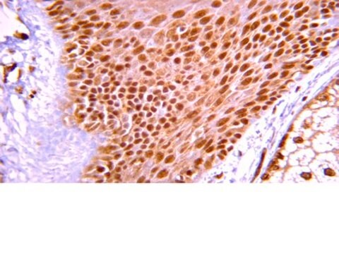 Anti-ARF1 Antibody, clone 3F1 clone 3F1, from mouse