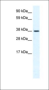 Anti-TRPM3 antibody produced in rabbit affinity isolated antibody