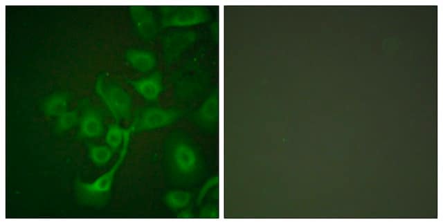 Anti-TIMP2 antibody produced in rabbit affinity isolated antibody