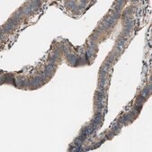Anti-ALDH1A2 antibody produced in rabbit Prestige Antibodies&#174; Powered by Atlas Antibodies, affinity isolated antibody, buffered aqueous glycerol solution