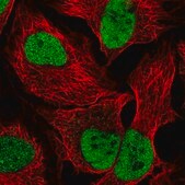 Anti-PDE7B antibody produced in rabbit Prestige Antibodies&#174; Powered by Atlas Antibodies, affinity isolated antibody, buffered aqueous glycerol solution