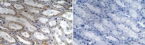 Anti-CPT2 Antibody, clone 1G7 ZooMAb&#174; Rabbit Monoclonal recombinant, expressed in HEK 293 cells