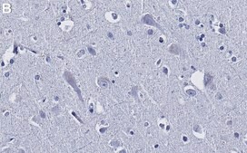 Anti-JNK2 Antibody, clone 1F16 ZooMAb&#174; Rabbit Monoclonal recombinant, expressed in HEK 293 cells