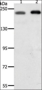 Anti-SMARCA4 antibody produced in rabbit affinity isolated antibody