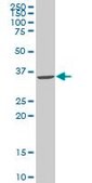 Monoclonal Anti-SNAI2 antibody produced in mouse clone 2F11, purified immunoglobulin, buffered aqueous solution