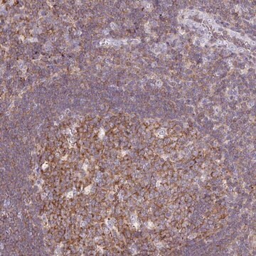 Anti-TPRG1 antibody produced in rabbit Prestige Antibodies&#174; Powered by Atlas Antibodies, affinity isolated antibody, buffered aqueous glycerol solution