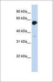 Anti-RARA antibody produced in rabbit affinity isolated antibody