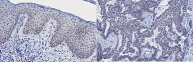 Anti-Vitamin D receptor Antibody, clone 9A7 clone 9A7, from rat