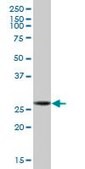 Anti-GCLM antibody produced in mouse purified immunoglobulin, buffered aqueous solution