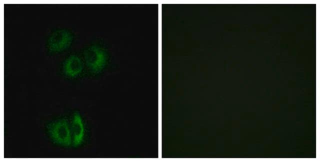 Anti-CELSR3 antibody produced in rabbit affinity isolated antibody