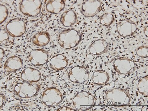 Monoclonal Anti-QARS antibody produced in mouse clone 5F5, purified immunoglobulin, buffered aqueous solution