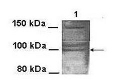 Anti-KCNQ2 (AB2) antibody produced in rabbit affinity isolated antibody