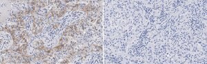 Anti-Integrin &#945;V&#946;3 Antibody, clone EM22703 ZooMAb&#174; Rabbit Monoclonal recombinant, expressed in HEK 293 cells