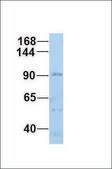Anti-AR antibody produced in rabbit affinity isolated antibody