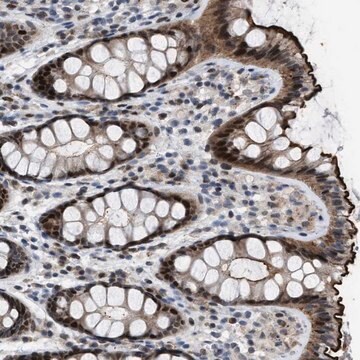 Anti-SETDB1 antibody produced in rabbit Prestige Antibodies&#174; Powered by Atlas Antibodies, affinity isolated antibody, buffered aqueous glycerol solution