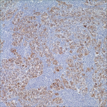 MART-1 (Melan A) (A103) Mouse Monoclonal Antibody