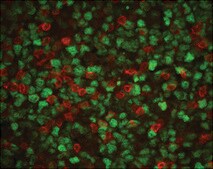 Monoclonal Anti-Proliferating Cell Nuclear Antigen antibody produced in mouse clone PC 10, ascites fluid