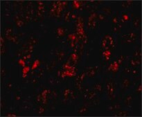 Anti-AFAP1L2 antibody produced in rabbit affinity isolated antibody, buffered aqueous solution