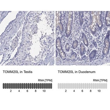 Anti-TOMM20L antibody produced in rabbit Prestige Antibodies&#174; Powered by Atlas Antibodies, affinity isolated antibody, buffered aqueous glycerol solution