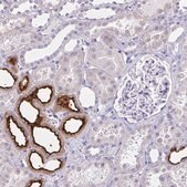 Anti-SLC12A3 antibody produced in rabbit Prestige Antibodies&#174; Powered by Atlas Antibodies, affinity isolated antibody, buffered aqueous glycerol solution