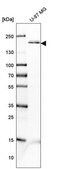 Anti-PDGFRB antibody produced in rabbit Prestige Antibodies&#174; Powered by Atlas Antibodies, affinity isolated antibody, buffered aqueous glycerol solution