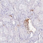 Anti-IGF1 antibody produced in rabbit Prestige Antibodies&#174; Powered by Atlas Antibodies, affinity isolated antibody, buffered aqueous glycerol solution