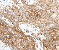 Anti-SCN10A antibody produced in rabbit affinity isolated antibody