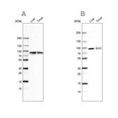 Anti-TF antibody produced in rabbit Ab1, Prestige Antibodies&#174; Powered by Atlas Antibodies, affinity isolated antibody, buffered aqueous glycerol solution