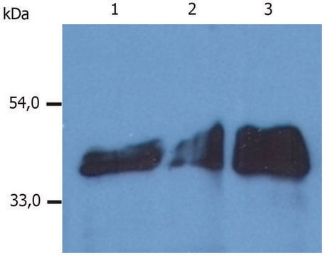 Monoclonal Anti-Cytokeratin 18 antibody produced in mouse clone DA-7