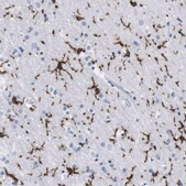 Anti-P2RY12 antibody produced in rabbit Prestige Antibodies&#174; Powered by Atlas Antibodies, affinity isolated antibody, buffered aqueous glycerol solution