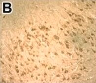 Anti-DNMT3B antibody produced in rabbit Prestige Antibodies&#174; Powered by Atlas Antibodies, affinity isolated antibody, buffered aqueous glycerol solution