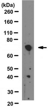 Anti-MMP-2 Antibody, a.a. 468-483 hMMP2, clone 42-5D11 clone 42-5D11, Chemicon&#174;, from mouse