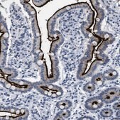 Anti-KCNC3 antibody produced in rabbit Prestige Antibodies&#174; Powered by Atlas Antibodies, affinity isolated antibody, buffered aqueous glycerol solution