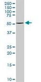 Anti-TYR antibody produced in rabbit purified immunoglobulin, buffered aqueous solution