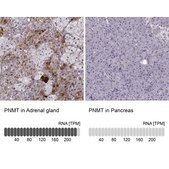 Anti-PNMT antibody produced in rabbit Prestige Antibodies&#174; Powered by Atlas Antibodies, affinity isolated antibody, buffered aqueous glycerol solution
