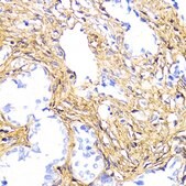Anti-COL1A1 antibody produced in rabbit