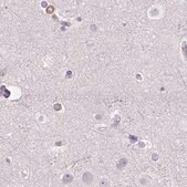 Anti-PRL antibody produced in rabbit Prestige Antibodies&#174; Powered by Atlas Antibodies, affinity isolated antibody