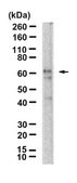 Anti-Aromatase Antibody, clone 1D23 ZooMAb&#174; Rabbit Monoclonal recombinant, expressed in HEK 293 cells