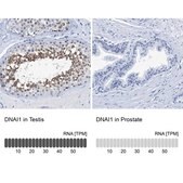 Anti-DNAI1 antibody produced in rabbit Prestige Antibodies&#174; Powered by Atlas Antibodies, affinity isolated antibody, buffered aqueous glycerol solution, Ab2