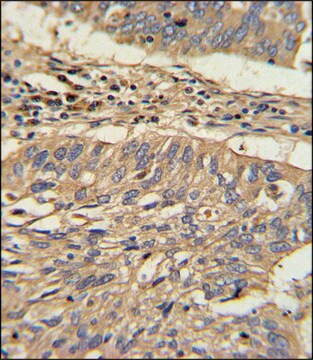 ANTI-HSP 60 (N-TERM) antibody produced in rabbit IgG fraction of antiserum, buffered aqueous solution