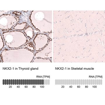 Monoclonal Anti-Nkx2-1 Antibody Produced In Mouse Prestige Antibodies&#174; Powered by Atlas Antibodies, clone CL14523, affinity isolated antibody, buffered aqueous glycerol solution