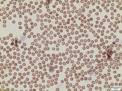 Leukocyte Peroxidase (Myeloperoxidase) Kit