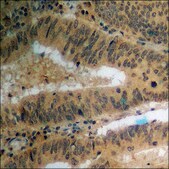 Anti-phospho-PPAR-&#947; (pSer112) antibody produced in rabbit affinity isolated antibody