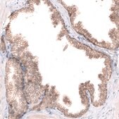 Monoclonal Anti-CLDN1 antibody produced in mouse Prestige Antibodies&#174; Powered by Atlas Antibodies, clone CL3698, purified immunoglobulin, buffered aqueous glycerol solution