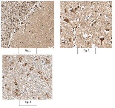 Anti-phospho PSD95 Antibody (Thr19) from rabbit, purified by affinity chromatography