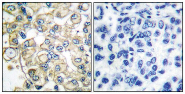 Anti-FGFR1 antibody produced in rabbit affinity isolated antibody