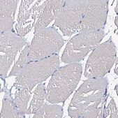 Anti-CSN2 antibody produced in rabbit Prestige Antibodies&#174; Powered by Atlas Antibodies, affinity isolated antibody, buffered aqueous glycerol solution