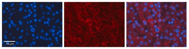 Anti-LCAT (AB1) antibody produced in rabbit affinity isolated antibody