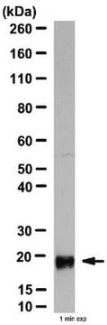 Anti-Interleukin-10 Antibody from rabbit, purified by affinity chromatography