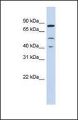 Anti-STAT3 antibody produced in rabbit affinity isolated antibody
